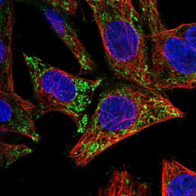 ICAT Antibody in Immunocytochemistry (ICC/IF)