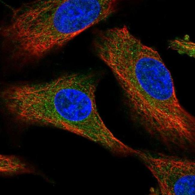 PDSS1 Antibody in Immunocytochemistry (ICC/IF)