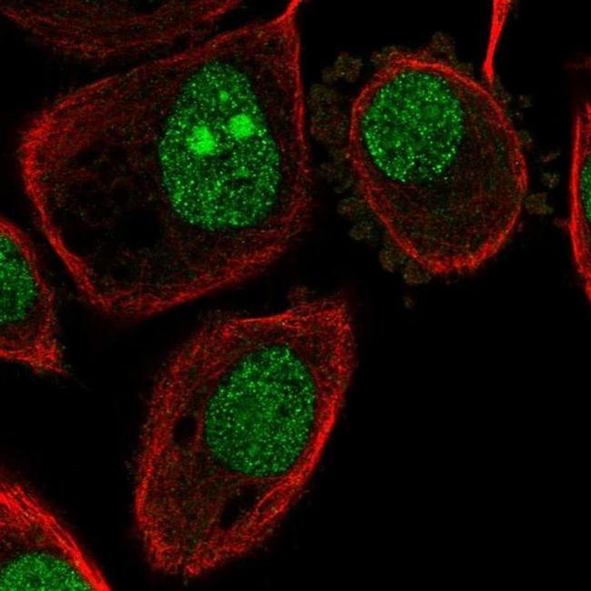 V-ATPase G1 Antibody in Immunocytochemistry (ICC/IF)