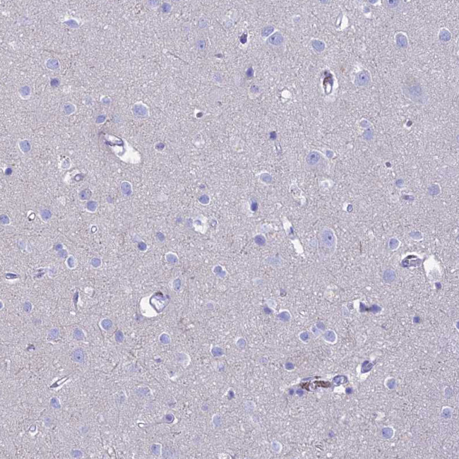 GNGT2 Antibody in Immunohistochemistry (Paraffin) (IHC (P))