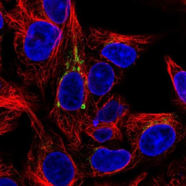 FUT6 Antibody in Immunocytochemistry (ICC/IF)