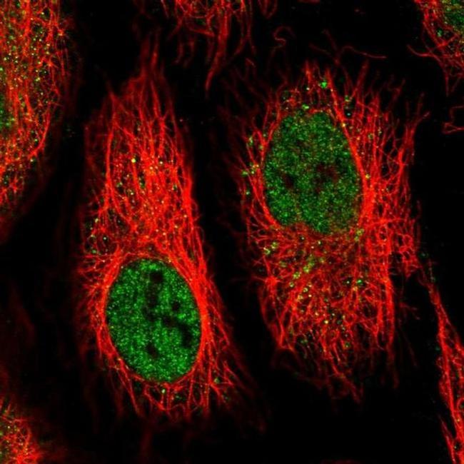 IFI44 Antibody in Immunocytochemistry (ICC/IF)