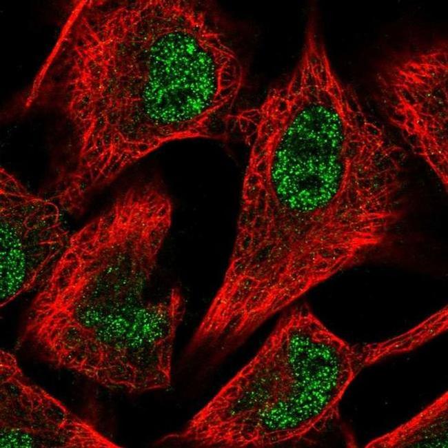 PFKFB3 Antibody in Immunocytochemistry (ICC/IF)