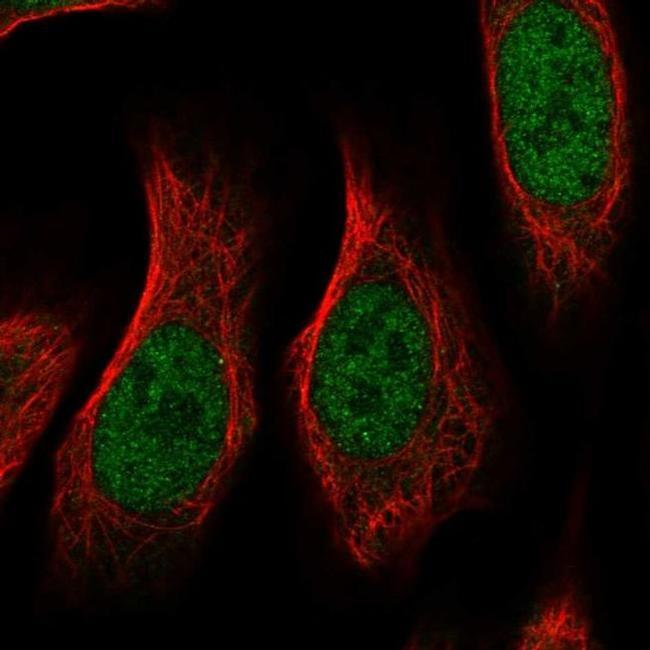 RGMA Antibody in Immunocytochemistry (ICC/IF)