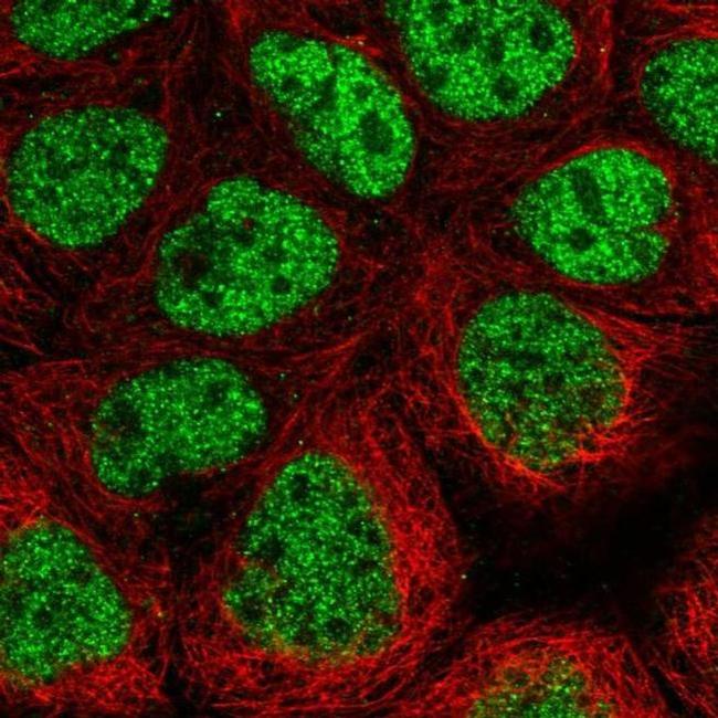 CDK8 Antibody in Immunocytochemistry (ICC/IF)