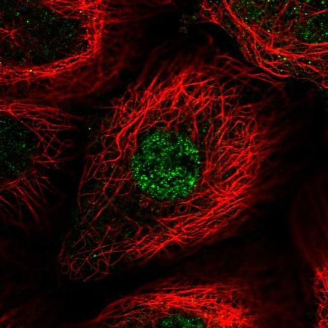 MCM8 Antibody in Immunocytochemistry (ICC/IF)