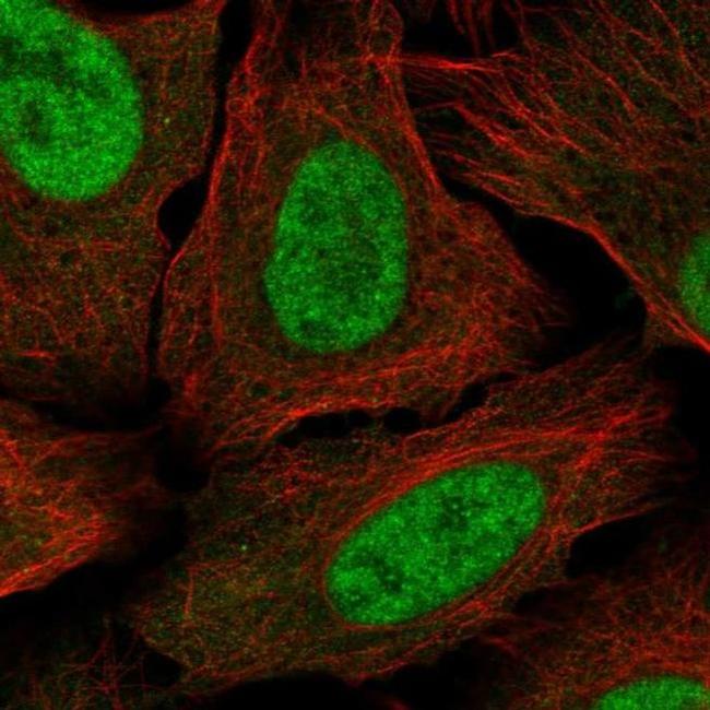 MED30 Antibody in Immunocytochemistry (ICC/IF)