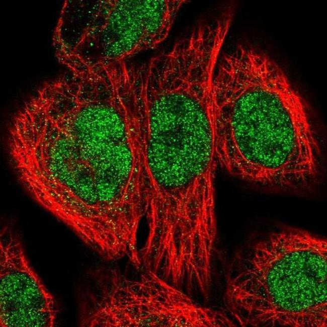 XPB Antibody in Immunocytochemistry (ICC/IF)