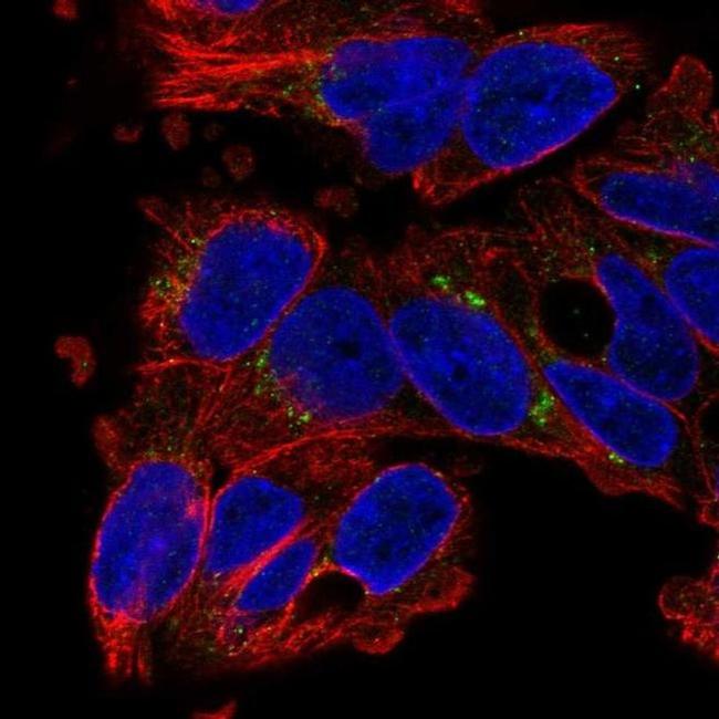 SLC29A3 Antibody in Immunocytochemistry (ICC/IF)