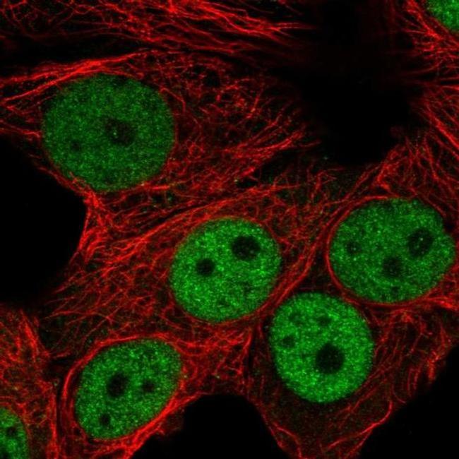 RNF168 Antibody in Immunocytochemistry (ICC/IF)