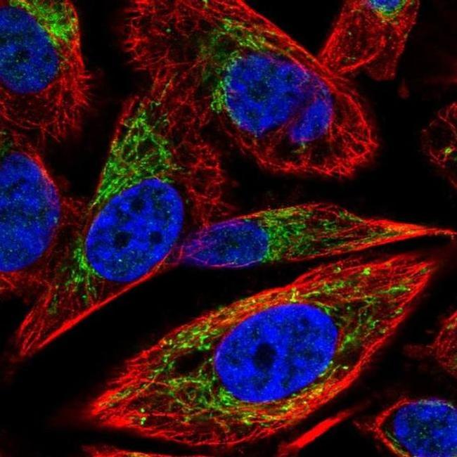 SLC25A5 Antibody in Immunocytochemistry (ICC/IF)