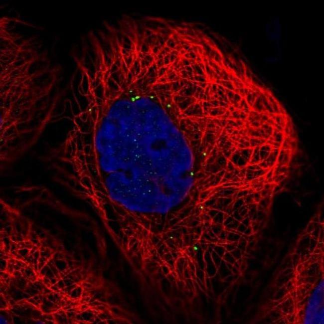 CTNS Antibody in Immunocytochemistry (ICC/IF)