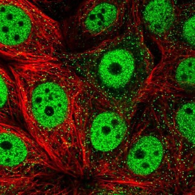 TOB1 Antibody in Immunocytochemistry (ICC/IF)