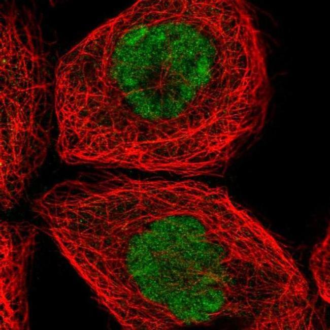 SPTY2D1 Antibody in Immunocytochemistry (ICC/IF)