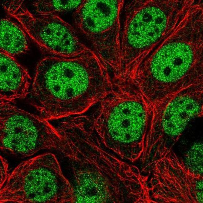 XPOT Antibody in Immunocytochemistry (ICC/IF)