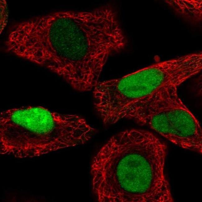 TALDO1 Antibody in Immunocytochemistry (ICC/IF)