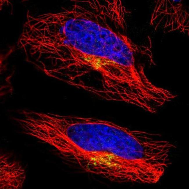 ATP7A Antibody in Immunocytochemistry (ICC/IF)