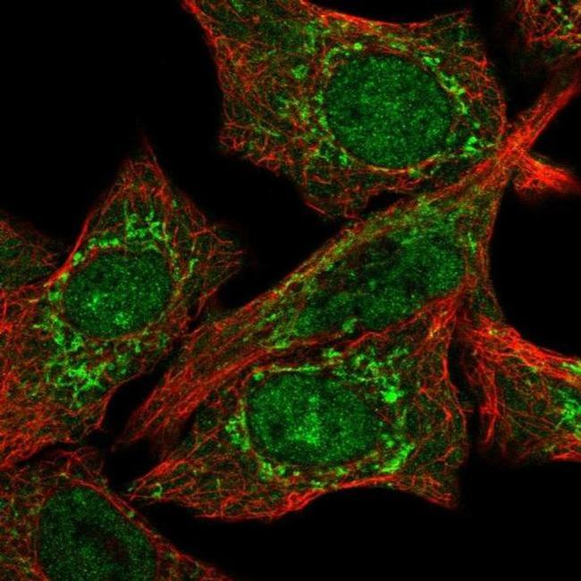 CLPX Antibody in Immunocytochemistry (ICC/IF)