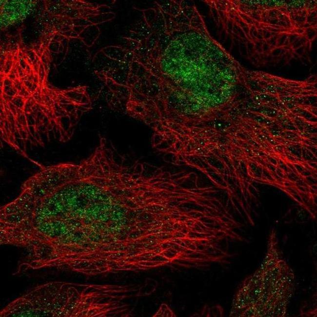 THOC5 Antibody in Immunocytochemistry (ICC/IF)