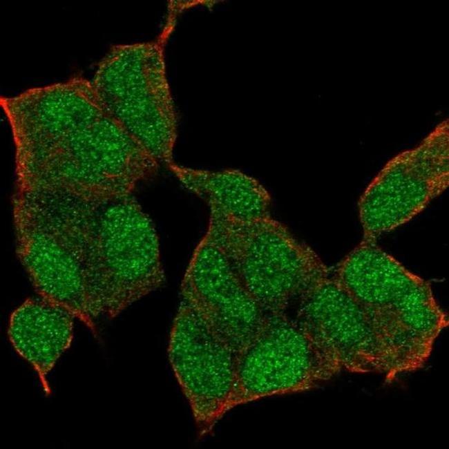 NSD1 Antibody in Immunocytochemistry (ICC/IF)