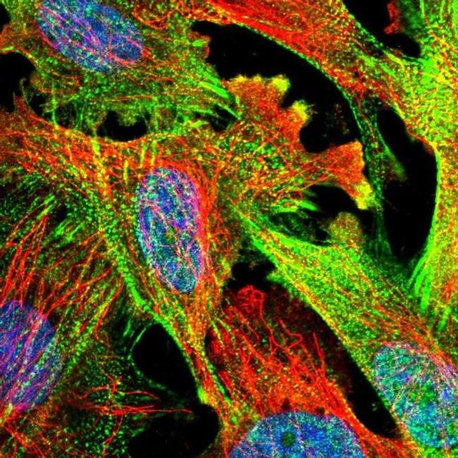 PDLIM7 Antibody in Immunocytochemistry (ICC/IF)