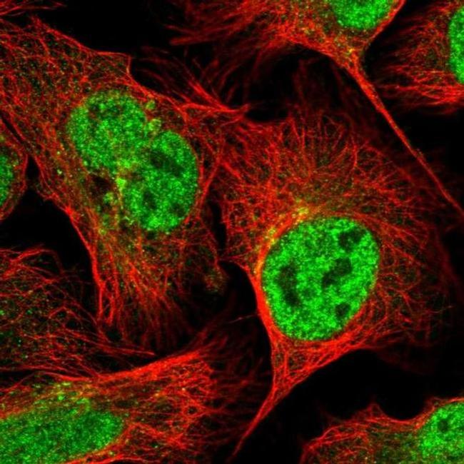 GOSR2 Antibody in Immunocytochemistry (ICC/IF)