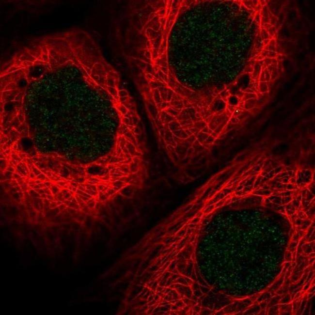 HLTF Antibody in Immunocytochemistry (ICC/IF)