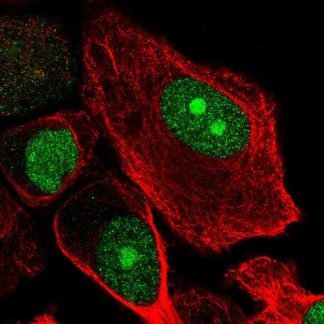 RBBP5 Antibody in Immunocytochemistry (ICC/IF)