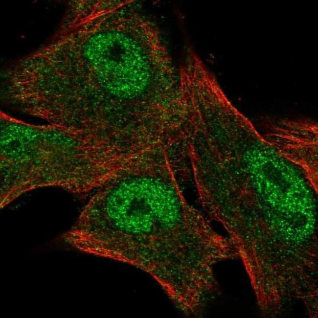 CITED1 Antibody in Immunocytochemistry (ICC/IF)