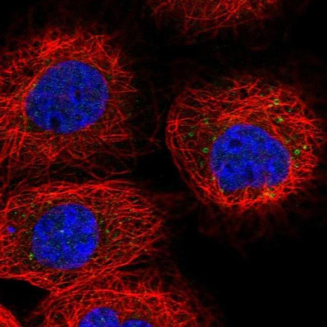 RDH10 Antibody in Immunocytochemistry (ICC/IF)