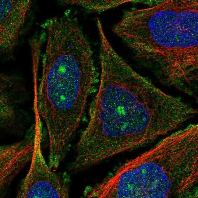 UTP20 Antibody in Immunocytochemistry (ICC/IF)