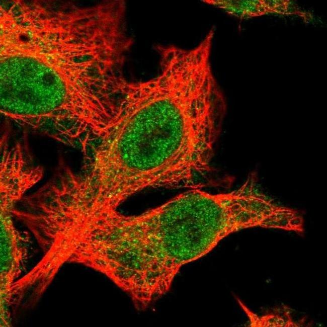 BTBD12 Antibody in Immunocytochemistry (ICC/IF)