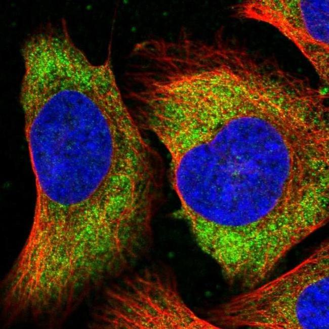 Tomosyn Antibody in Immunocytochemistry (ICC/IF)