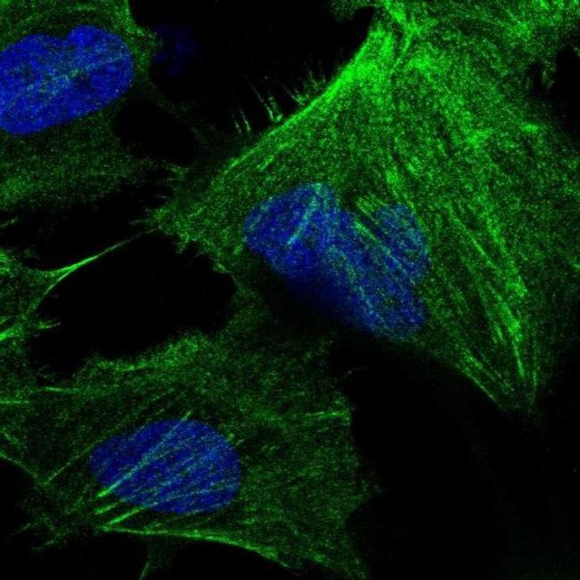 CTPS Antibody in Immunocytochemistry (ICC/IF)