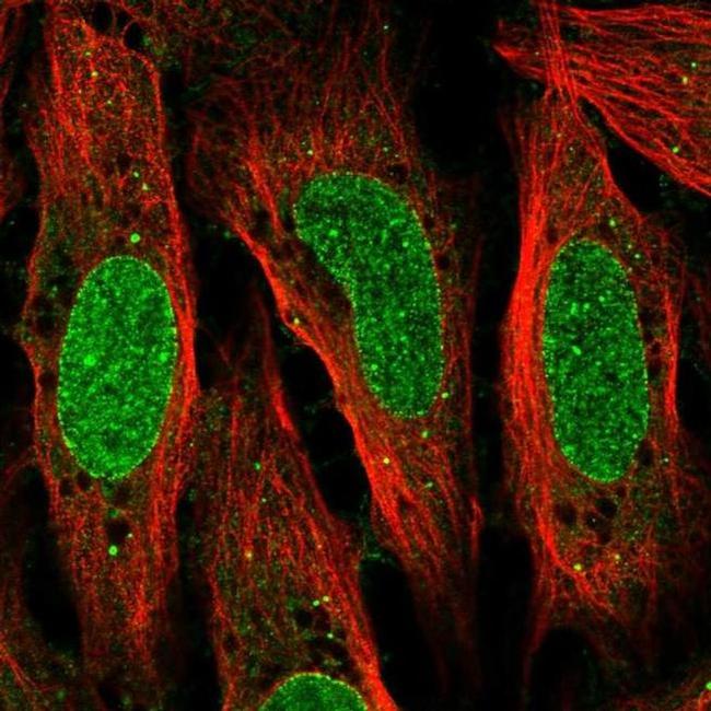 QRICH2 Antibody in Immunocytochemistry (ICC/IF)