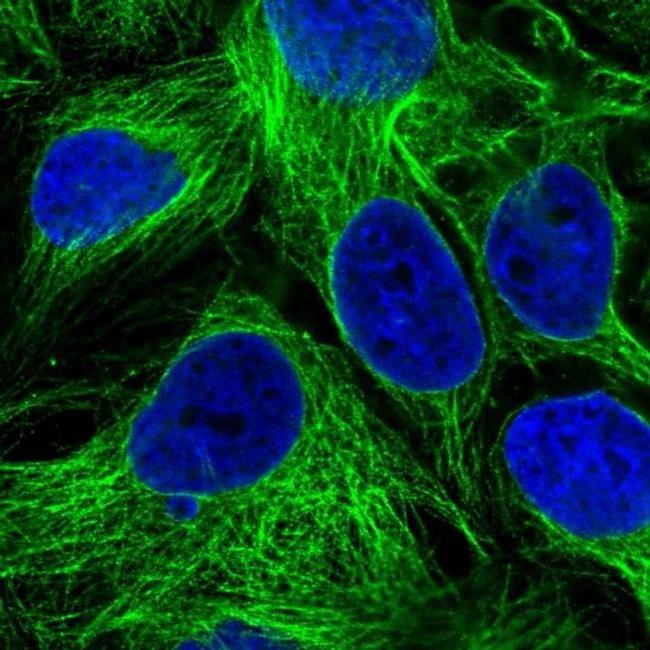 PMAT Antibody in Immunocytochemistry (ICC/IF)