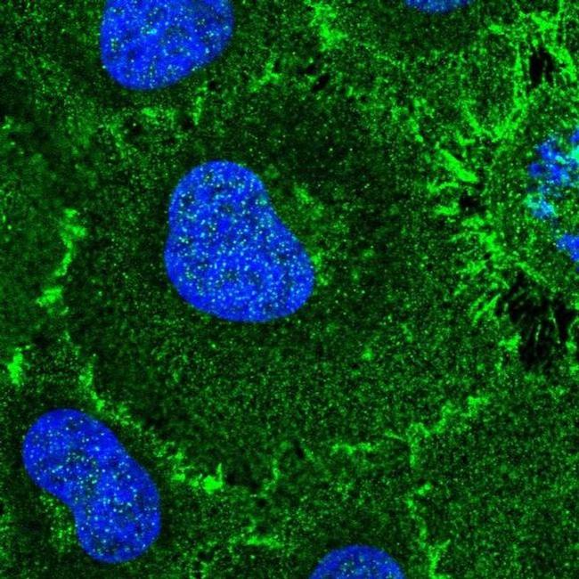 ROBO1 Antibody in Immunocytochemistry (ICC/IF)