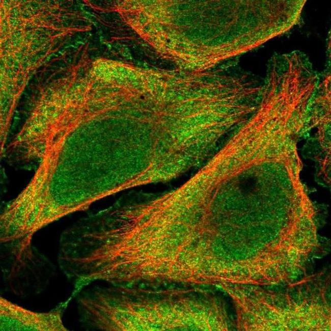 BEND6 Antibody in Immunocytochemistry (ICC/IF)