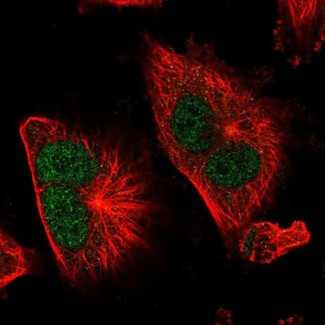 TSR1 Antibody in Immunocytochemistry (ICC/IF)