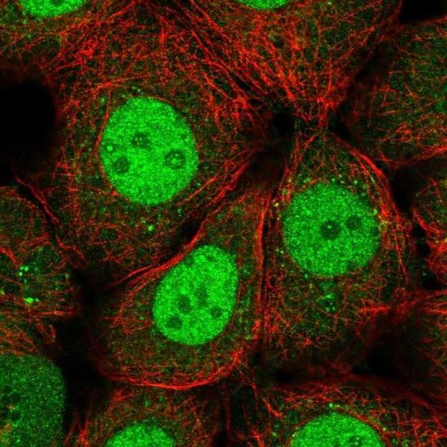 RFXANK Antibody in Immunocytochemistry (ICC/IF)