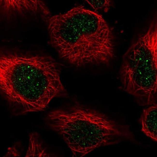 CENPB Antibody in Immunocytochemistry (ICC/IF)