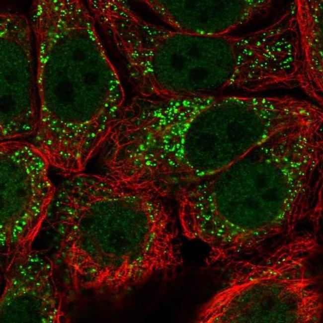 URM1 Antibody in Immunocytochemistry (ICC/IF)