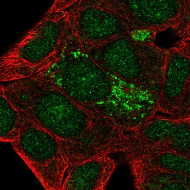 DHRS2 Antibody in Immunocytochemistry (ICC/IF)