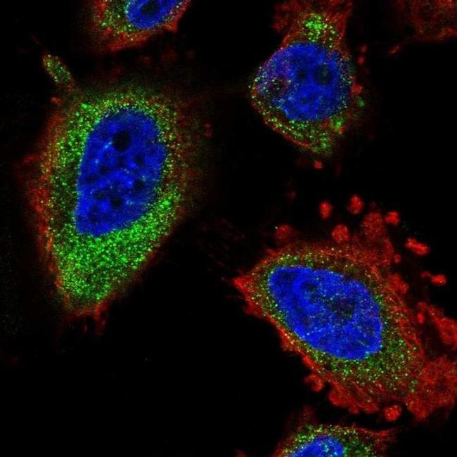 ELOVL5 Antibody in Immunocytochemistry (ICC/IF)