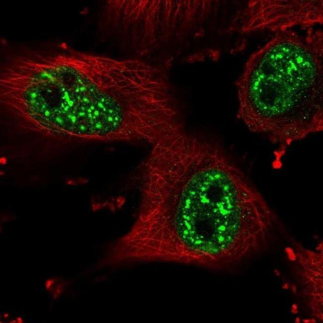 HP1BP3 Antibody in Immunocytochemistry (ICC/IF)