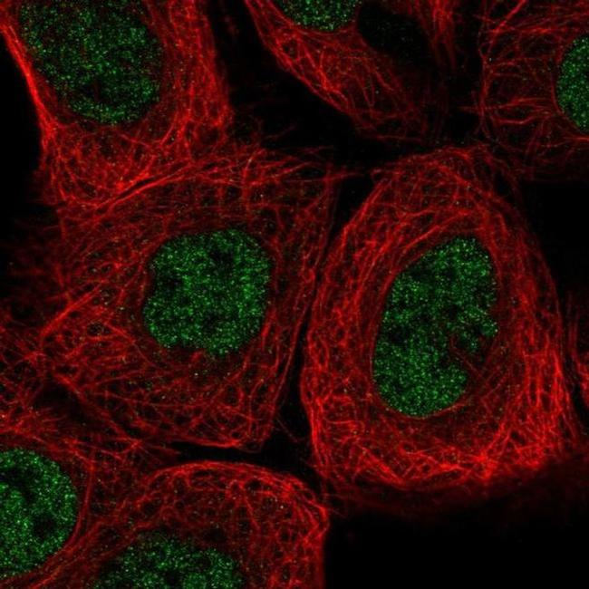 AGL Antibody in Immunocytochemistry (ICC/IF)