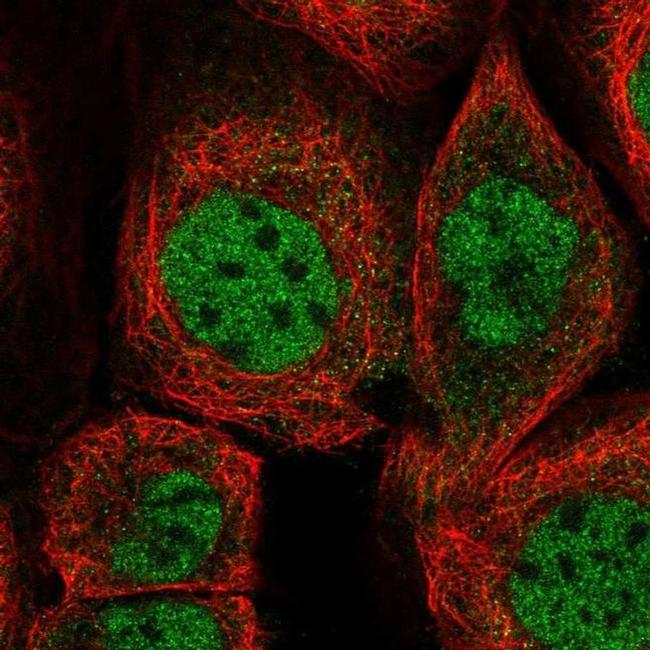 ZMAT3 Antibody in Immunocytochemistry (ICC/IF)