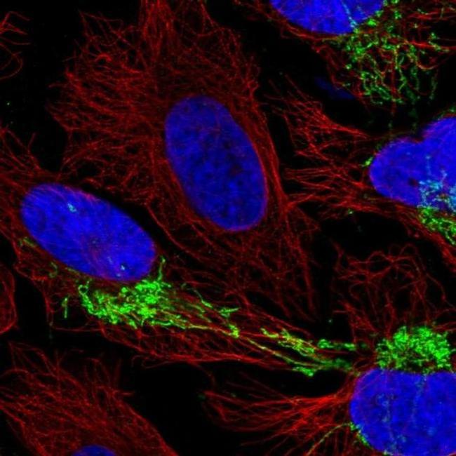 CPOX Antibody in Immunocytochemistry (ICC/IF)