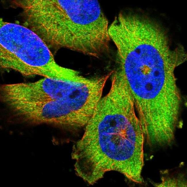 GLD2 Antibody in Immunocytochemistry (ICC/IF)