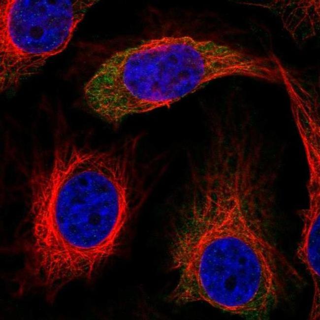 IRS2 Antibody in Immunocytochemistry (ICC/IF)